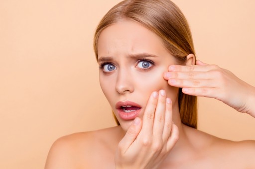 SİYAH NOKTA NEDİR, NEDEN OLUŞUR VE NASIL ÖNLENİR?