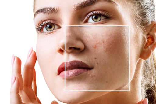 YSKINZ ile Kore Kozmetik Dünyasını Keşfedin!