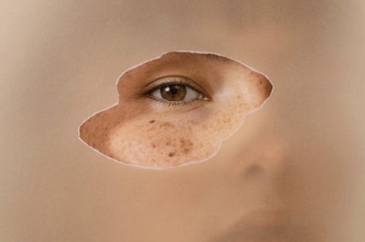 Cilt Sağlığını Korumak İçin Neler Yapmalıyız?