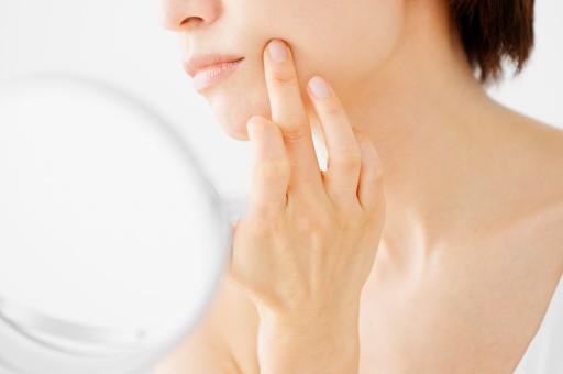 Cilt Lekelerinden Kurtulmak Mümkün Mü?