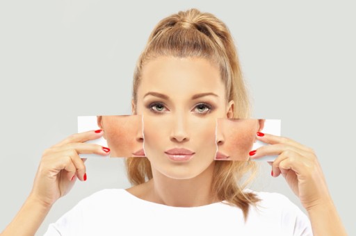 Yaz Bitti, Şimdi Güneş Lekelerinden Arınma Zamanı