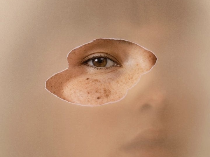 Cilt Sağlığını Korumak İçin Neler Yapmalıyız? 